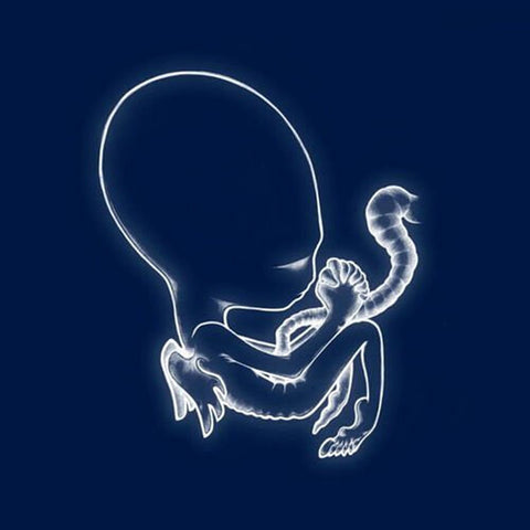 Sigur Ros - Agaetis Byrjun LP – Eroding Winds