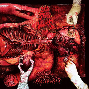 200 Stab Wounds - Manual Manic Procedures LP